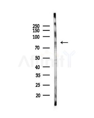 CDH8 Antibody - Western blot analysis of lysates from HUVEC cells(LPS, 4h treatment), using CDH8 Antibody at 1/1000 dilution.