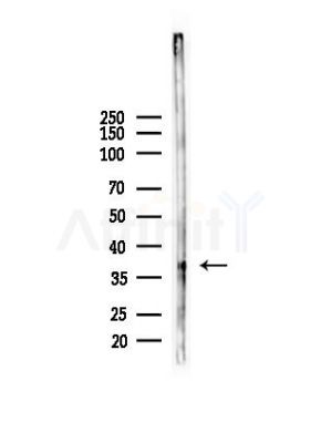 CCRL1 Antibody - Western blot analysis of lysates from RAW264.