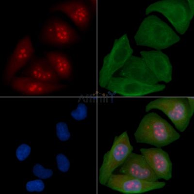CDCA2 Antibody - DF3543 staining Hela cells by IF/ICC.