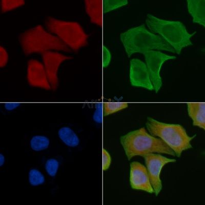 Collagen XIII  alpha 1 Antibody - DF3554 staining Hela cells(30min of UV treatment) by IF/ICC.