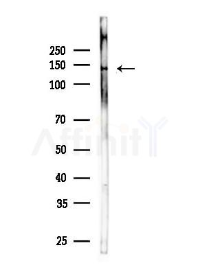 Collagen XX  alpha 1 Antibody - Western blot analysis of lysates from Mouse brain, using Collagen XX  alpha 1 Antibody at 1/1000 dilution.
