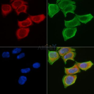 COX17 Antibody - DF3558 staining Hela cells(30min of UV treatment) by IF/ICC.