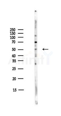 Cytochrome P450 19A1 Antibody - Western blot analysis of lysates from COLO205 cells(heat-shock,45min treatment), using Cytochrome P450 19A1 Antibody at 1/1000 dilution.