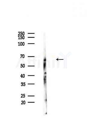Cytochrome P450 2S1 Antibody - Western blot analysis of lysates from Hela cells(heat-shock,45min treatment), using Cytochrome P450 2S1 Antibody at 1/1000 dilution.