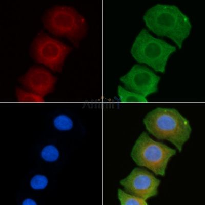 Cytochrome P450 2U1 Antibody - DF3582 staining Hela cells(45min of heat-shock) by IF/ICC.