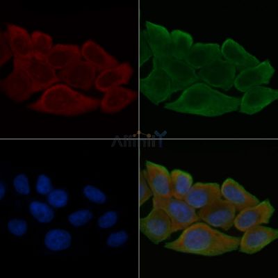 Cytochrome P450 4Z1 Antibody - DF3590 staining Hela cells(30min of UV treatment) by IF/ICC.