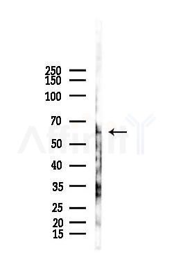 Cytochrome P450 51A1 Antibody - Western blot analysis of lysates from Hela cells(LPS,4h treatment), using Cytochrome P450 51A1 Antibody at 1/1000 dilution.