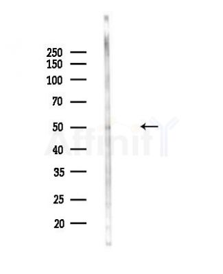 SNT2 Antibody - Western blot analysis of lysates from Mouse lung, using SNT2 Antibody at 1/1000 dilution.