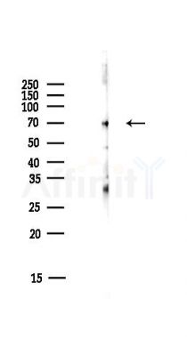 GBP1 Antibody - Western blot analysis of lysates from HUVEC cells(starvation,24h treatment), using GBP1 Antibody at 1/1000 dilution.