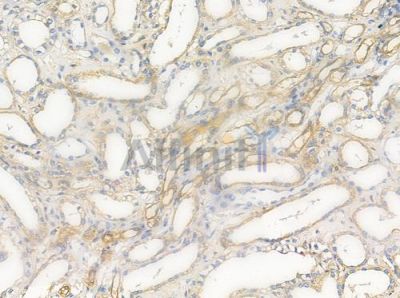 BCL2L2 Antibody - DF3607 at 1/100 staining human normal kidney tissue by IHC-P.