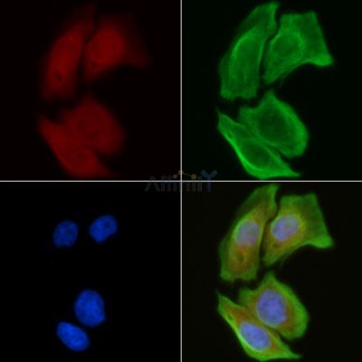 LAMC1 Antibody - DF3619 staining Hela cells(30min of UV treatment) by IF/ICC.