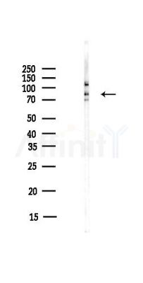 MLH1 Antibody - Western blot analysis of lysates from COLO205 cells(heat-shock,45min treatment), using MLH1 Antibody at 1/1000 dilution.