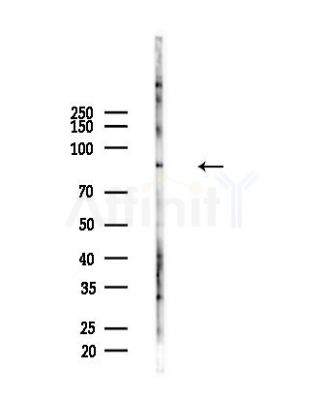 RAD54 Antibody - Western blot analysis of lysates from Hela cells(heat-shock,45min treatment), using RAD54 Antibody at 1/1000 dilution.