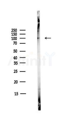 STAT5 Antibody - Western blot analysis of lysates from COLO205 cells(heat-shock,45min treatment), using STAT5 Antibody at 1/1000 dilution.