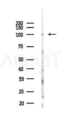 ORC1L Antibody - Western blot analysis of lysates from COLO205 cells(heat-shock,45min treatment), using ORC1L Antibody at 1/1000 dilution.