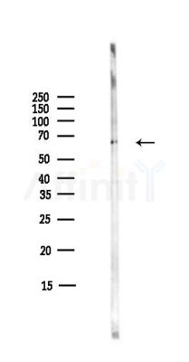 PSMD3 Antibody - Western blot analysis of lysates from COLO205 cells(heat-shock,45min treatment), using PSMD3 Antibody at 1/1000 dilution.