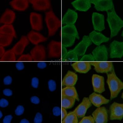 MRPS16 Antibody - DF3647 staining Hela cells(30min of UV treatment) by IF/ICC.
