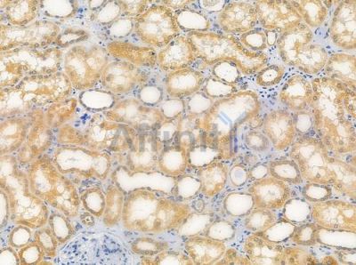 MRPL24 Antibody - DF3666 at 1/100 staining human normal kidney tissue by IHC-P.