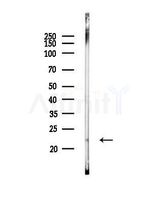 MRPL35 Antibody - Western blot analysis of lysates from A549 cells, using MRPL35 Antibody at 1/1000 dilution.