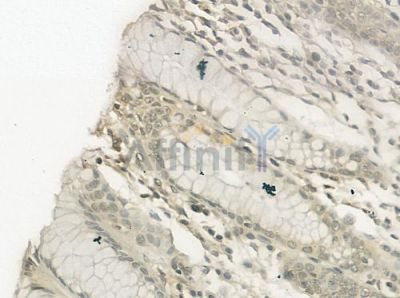 RPS19 Antibody - DF3680 at 1/100 staining human normal gastric tissue by IHC-P.