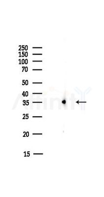 RPS3 Antibody - Western blot analysis of lysates from COLO205 cells(heat-shock,45min treatment), using RPS3 Antibody at 1/1000 dilution.