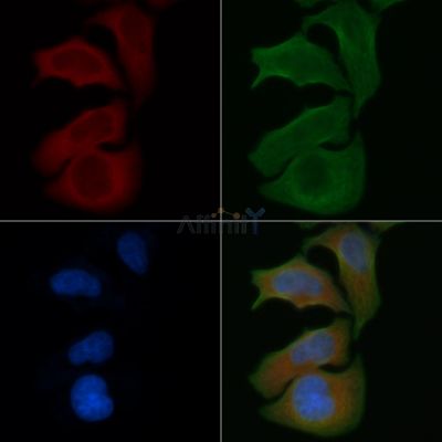 RPS4X Antibody - DF3685 staining Hela cells by IF/ICC.