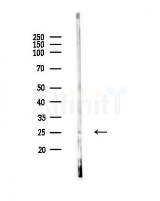 RPS5 Antibody - Western blot analysis of lysates from EC304 cells, using RPS5 Antibody at 1/1000 dilution.