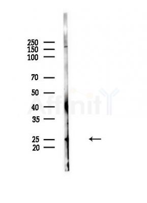 RPS5 Antibody - Western blot analysis of lysates from HUVEC cells(LPS,4h treatment), using RPS5 Antibody at 1/1000 dilution.