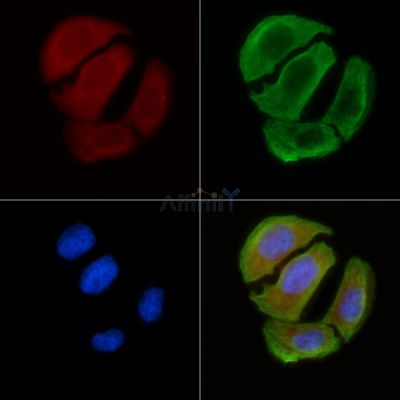 RPL12 Antibody - DF3697 staining Hela cells(30min of UV treatment) by IF/ICC.