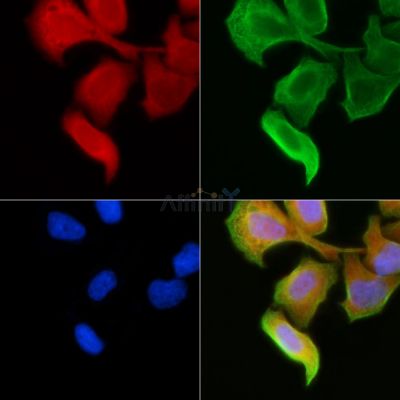 RPL23 Antibody - DF3702 staining Hela cells(30min of UV treatment) by IF/ICC.