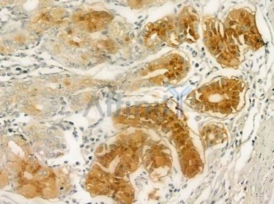 RPL3 Antibody - DF3706 at 1/100 staining human normal gastric tissue by IHC-P.
