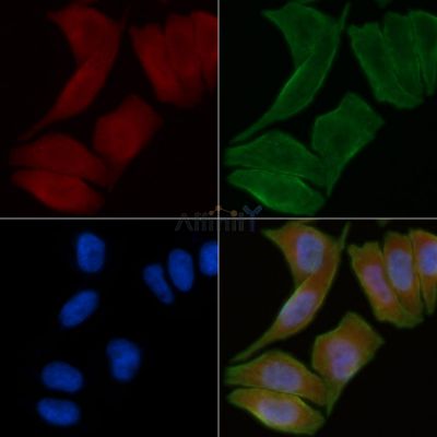 ABHD14A Antibody - DF3718 staining Hela cells(30min of UV treatment) by IF/ICC.