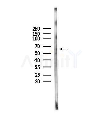 SLC33A1 Antibody - Western blot analysis of lysates from Hela cells(heat-shock,45min treatment), using SLC33A1 Antibody at 1/1000 dilution.