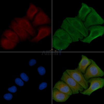ACOT8 Antibody - DF3736 staining Hela cells by IF/ICC.