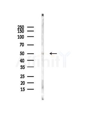 LPCAT2 Antibody - Western blot analysis of lysates from Rat brain, using LPCAT2 Antibody at 1/1000 dilution.