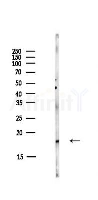 ARF6 Antibody - Western blot analysis of lysates from HUVEC cells(starvation,24h treatment), using ARF6 Antibody at 1/1000 dilution.