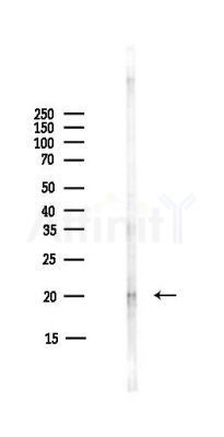 ARF6 Antibody - Western blot analysis of lysates from COLO205 cells(heat-shock,45min treatment), using ARF6 Antibody at 1/1000 dilution.