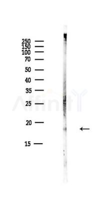 ARF6 Antibody - Western blot analysis of lysates from Mouse liver, using ARF6 Antibody at 1/1000 dilution.