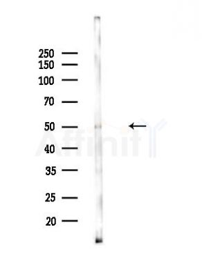 ARFGAP1 Antibody - Western blot analysis of lysates from Mouse lung, using ARFGAP1 Antibody at 1/1000 dilution.