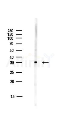 AKR1B1 Antibody - Western blot analysis of lysates from HUVEC cells(starvation,24h treatment), using AKR1B1 Antibody at 1/1000 dilution.