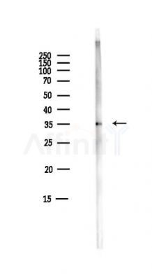 AKR1B1 Antibody - Western blot analysis of lysates from Mouse liver, using AKR1B1 Antibody at 1/1000 dilution.