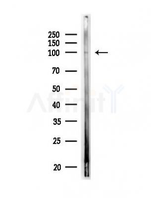 AMPD2 Antibody - Western blot analysis of lysates from MDA-MB-231 cells, using AMPD2 Antibody at 1/1000 dilution.