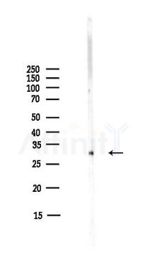 AIBP Antibody - Western blot analysis of lysates from COLO205 cells(heat-shock,45min treatment), using AIBP Antibody at 1/1000 dilution.