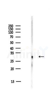 AIBP Antibody - Western blot analysis of lysates from HUVEC cells(starvation,24h treatment), using AIBP Antibody at 1/1000 dilution.