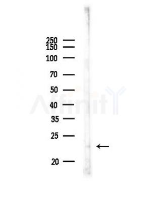 ATP5S Antibody - Western blot analysis of lysates from Rat muscle, using ATP5S Antibody at 1/1000 dilution.