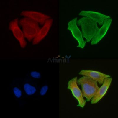 ATP5S Antibody - DF3808 staining Hela cells(30min of UV treatment) by IF/ICC.