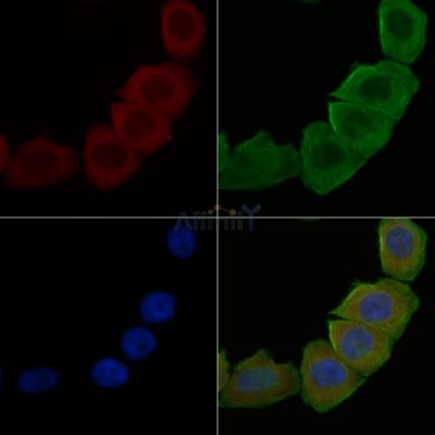 ABCA8 Antibody - DF3810 staining Hela cells(30min of UV treatment) by IF/ICC.