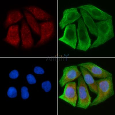 ABCB7 Antibody - DF3812 staining Hela cells(30min of UV treatment) by IF/ICC.