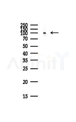 ABCF1 Antibody - Western blot analysis of lysates from Hela cells(starvation,24h treatment), using ABCF1 Antibody at 1/1000 dilution.