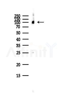ABCF1 Antibody - Western blot analysis of lysates from HepG2 cells(heat-shock,45min treatment), using ABCF1 Antibody at 1/1000 dilution.